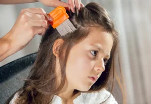 lice treatment