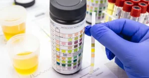 Does Ketamine Show Up on a 12 Panel