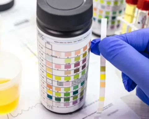 Does Ketamine Show Up on a 12 Panel